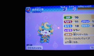 �d���O���u�̉摜